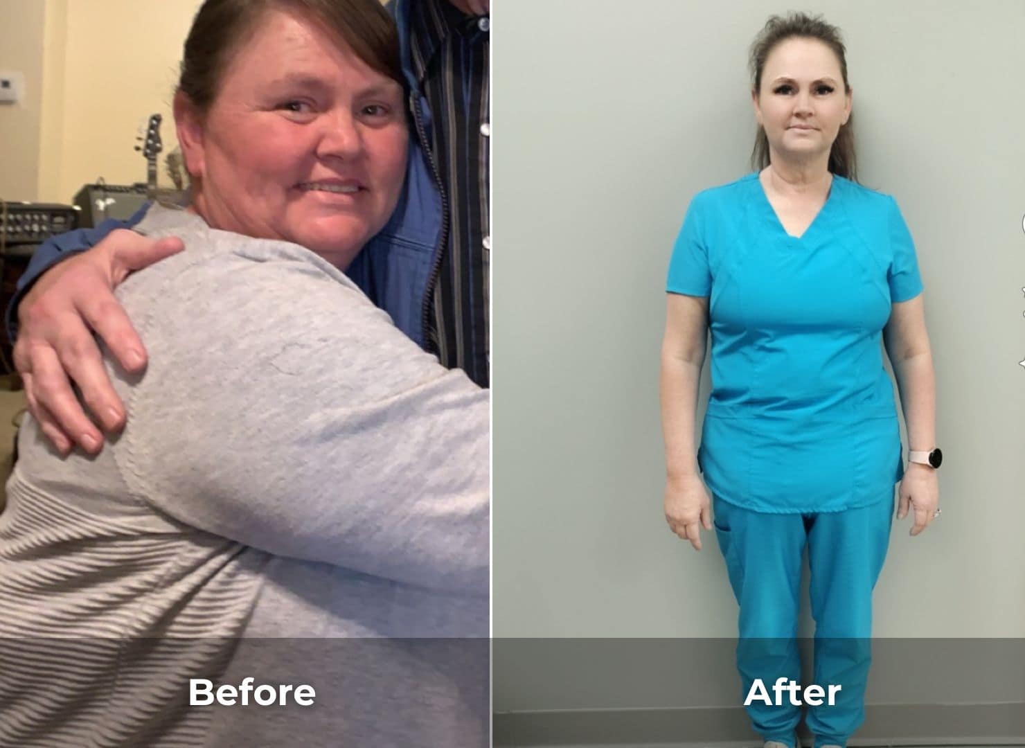 Before and After Evolve (6)